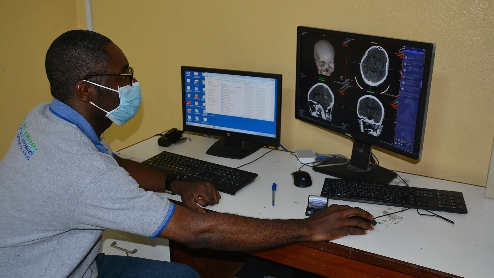 Does AI Actually Improve Radiology Accuracy? What the Prospective Trials Show in 2026
