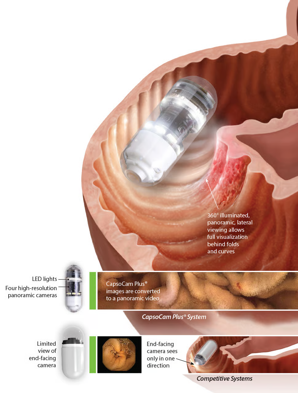 Computer Vision in GI: Transforming Capsule Endoscopy into Asynchronous Care