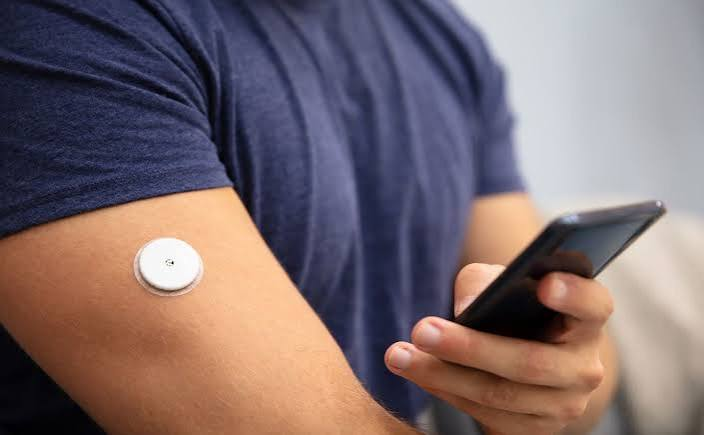 Dexcom launches first over the counter glucose sensor in United States